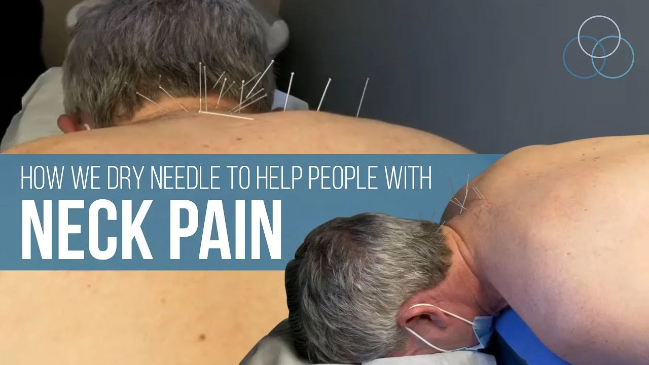 Chiropractic Towson MD Dry Needling For Neck Pain